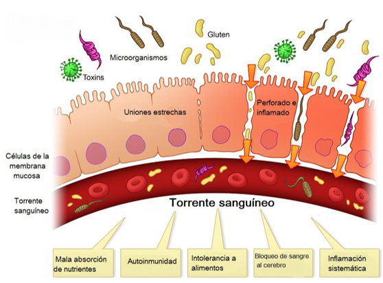 Permeabilidad Intestinal